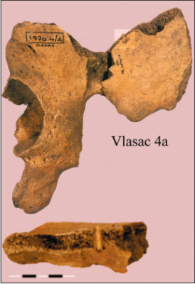 Figure 4: reconstructed ilium of Vlasac burial 4a, showing embedded projectile. (Image: Roksandic, 2006)